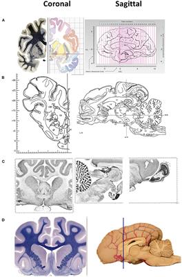 Mapping sheep to human brain: The need for a sheep brain atlas